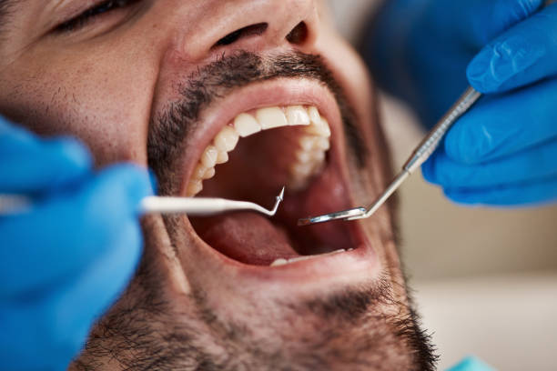 Emergency Dental Services in Longview, WA